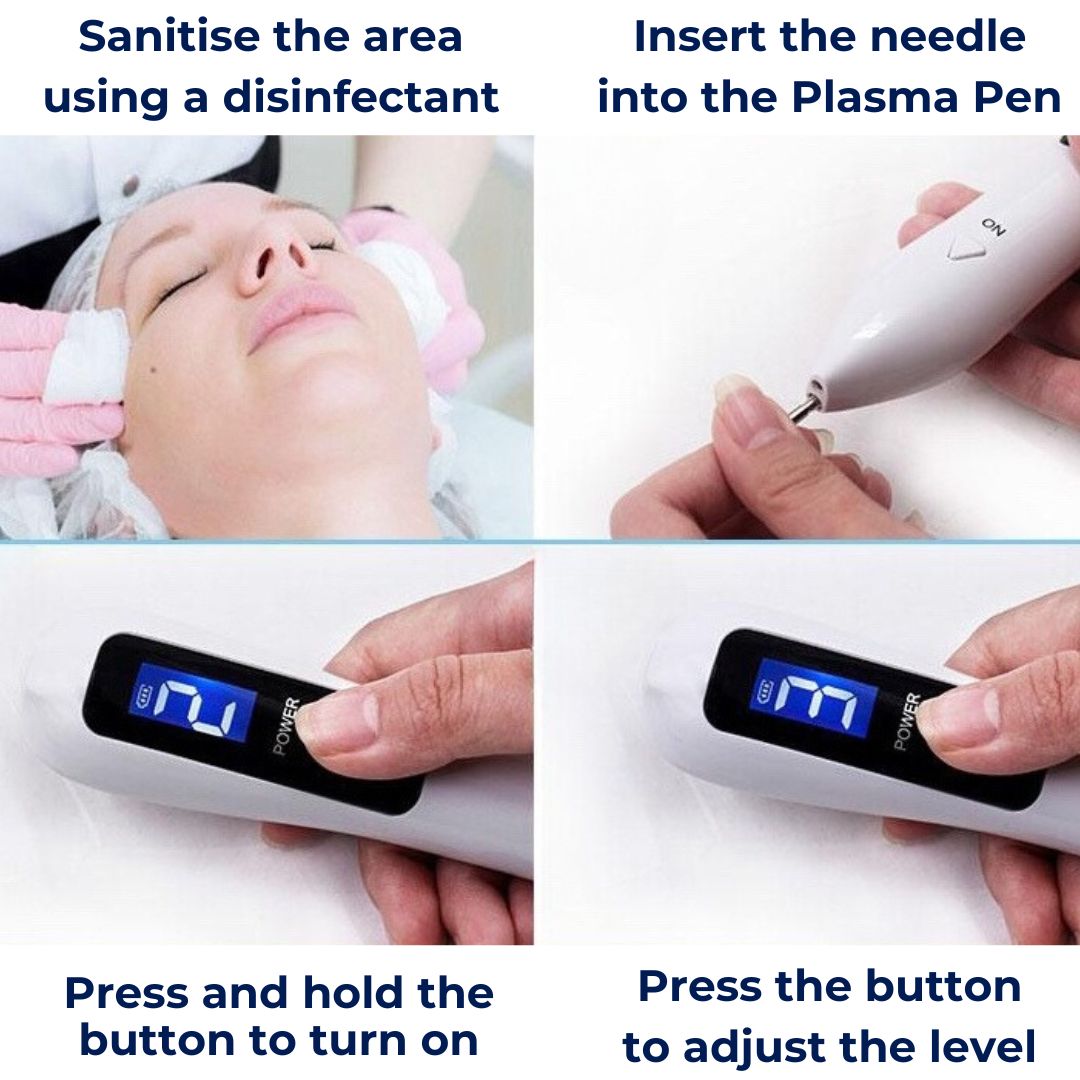DermaLux Plasma Pen — nieinwazyjne urządzenie do korekcji w domu