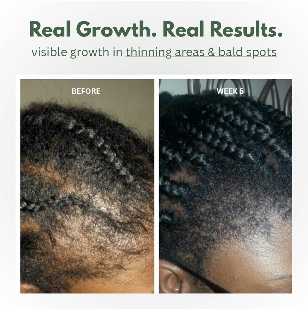 Batana Treatment Serum — Lightweight Calming Scalp & Strand Formula