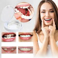 Facettes dentaires amovibles NovaBright pour dents supérieures et inférieures — sourire naturel instantané