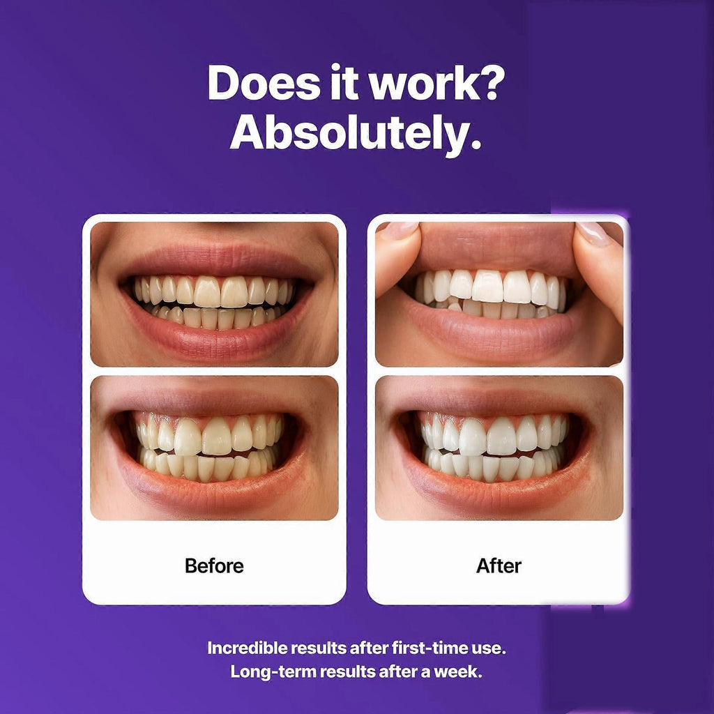 LumiSmile V34 Purple Teeth Whitening Strips — PAP+ Color Correction