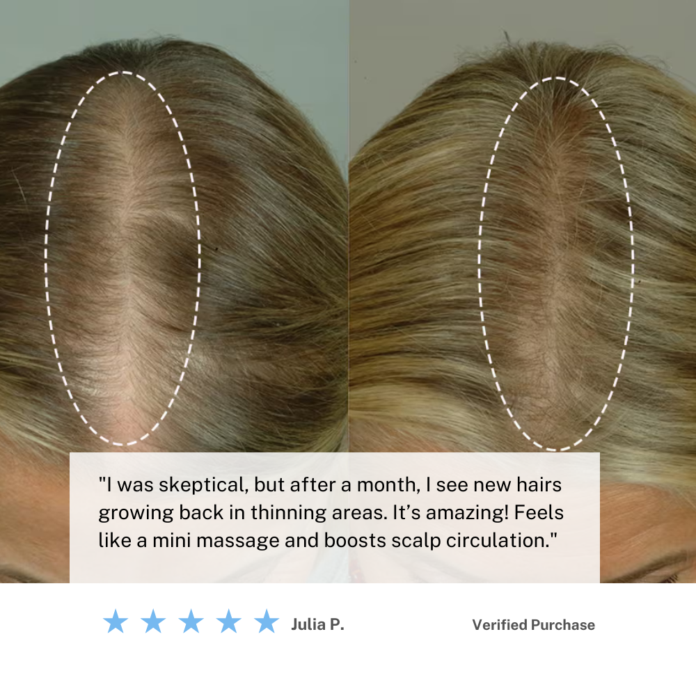 Kabellose Kopfhautmassagebürste — Mikrovibrationen für das Haarwachstum