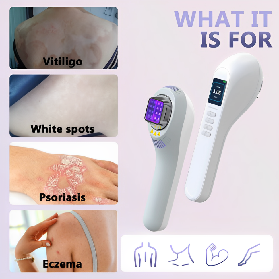 Přenosná UVB lampa 308 nm – dobíjecí systém pro ozařování pokožky