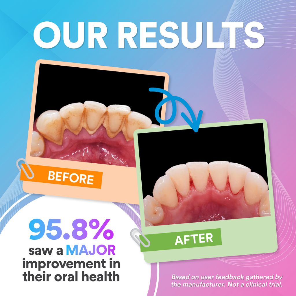 Idropulsore dentale Pro: freschezza, potenza e precisione in un’unica soluzione