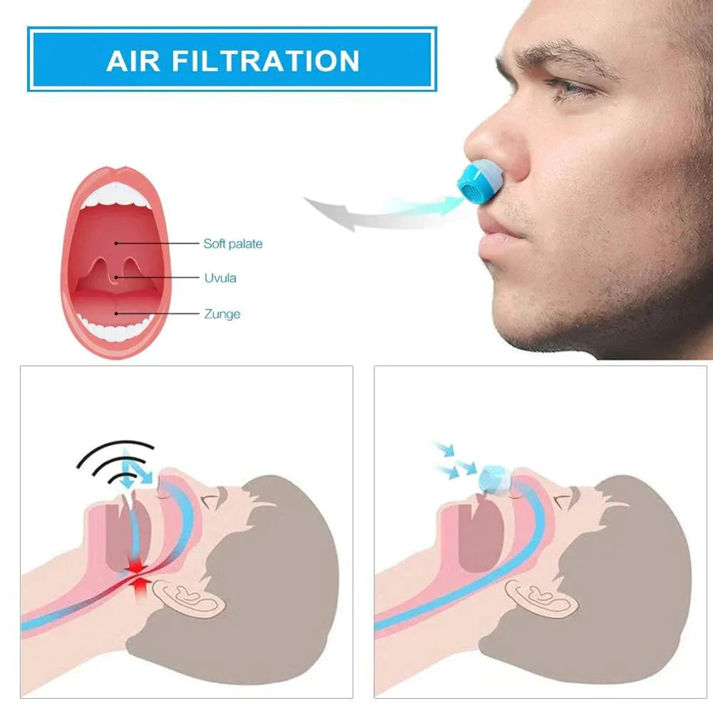 Dispositivo Micro-CPAP de ventilação para um alívio antirronco sem complicações | Filindra