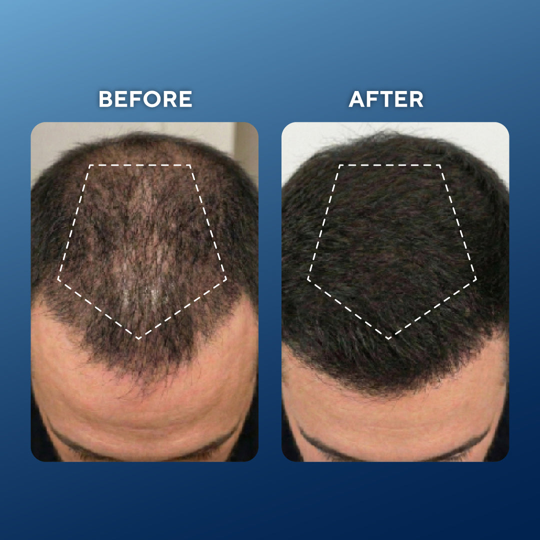 銅ペプチド revitalizing ヘアセラム — 健やかでふんわり見える髪を目指す頭皮用トリートメント