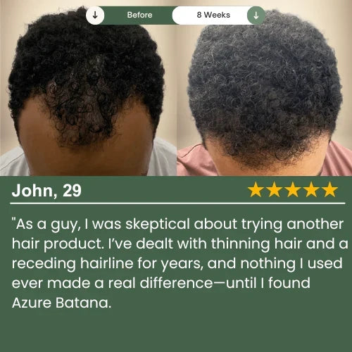 Dueto de champô e condicionador de Batana — conjunto completo para o cuidado do cabelo
