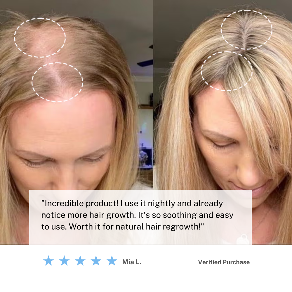 Kabellose Kopfhautmassagebürste — Mikrovibrationen für das Haarwachstum