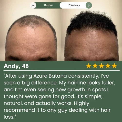 Batana Treatment Serum — Lightweight Calming Scalp & Strand Formula