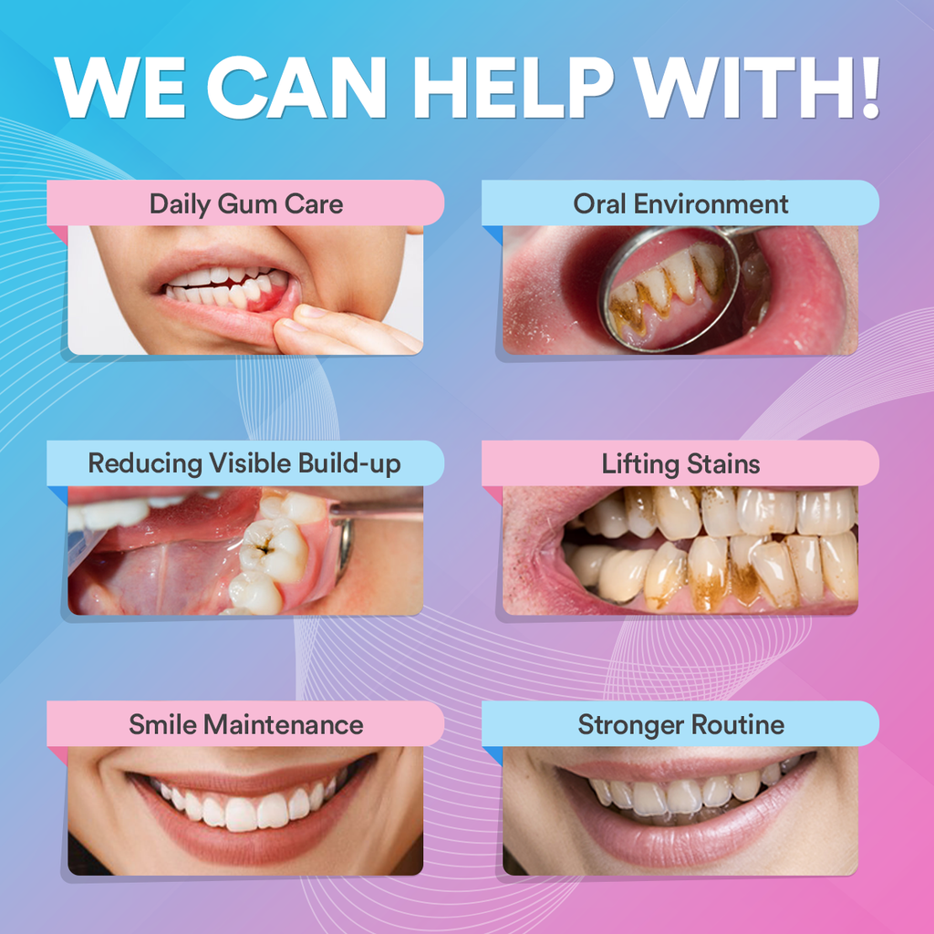Elite Smile Technology prémium szónikus fogtisztító — professzionális szájápolási eszköz