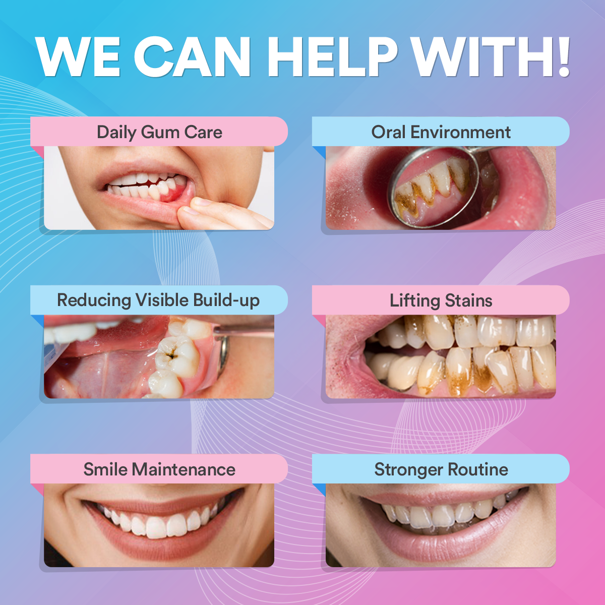 Elite Smile Technology prémium szónikus fogtisztító — professzionális szájápolási eszköz