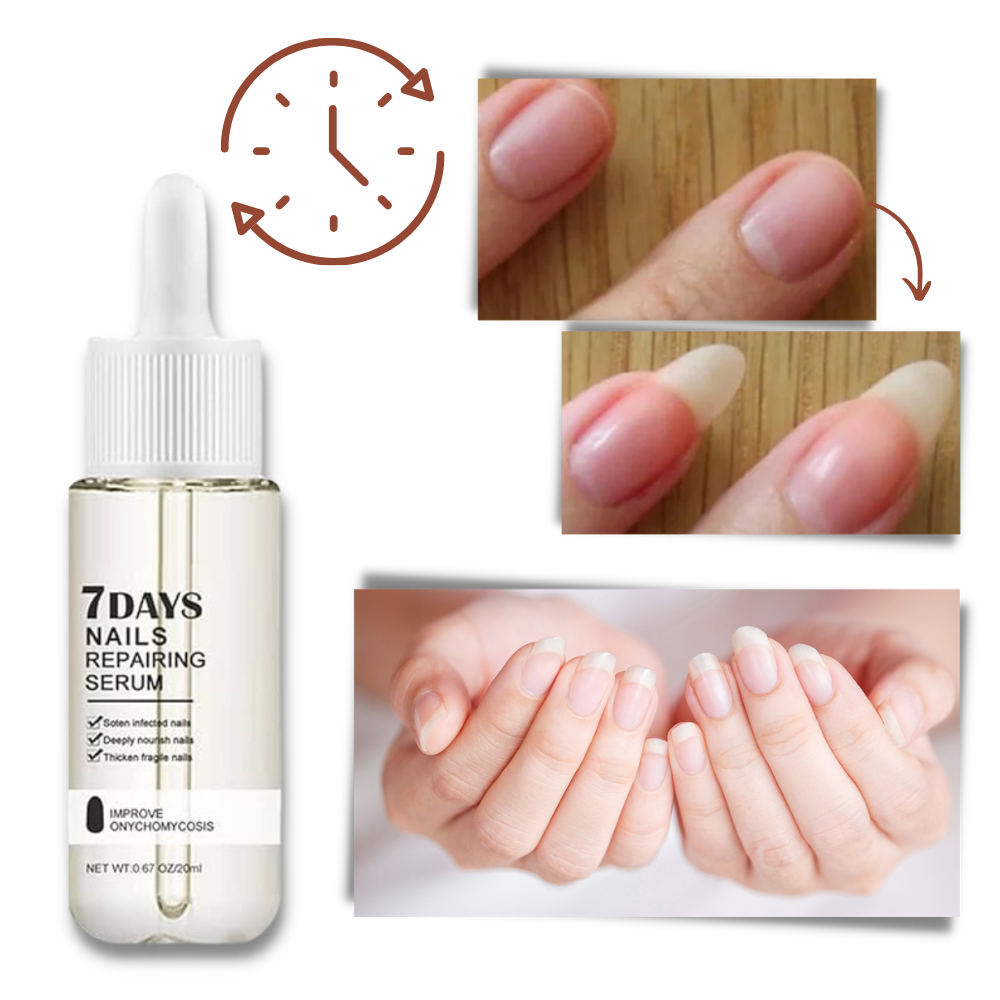 7 Days Nail Repair Essence | Filindra