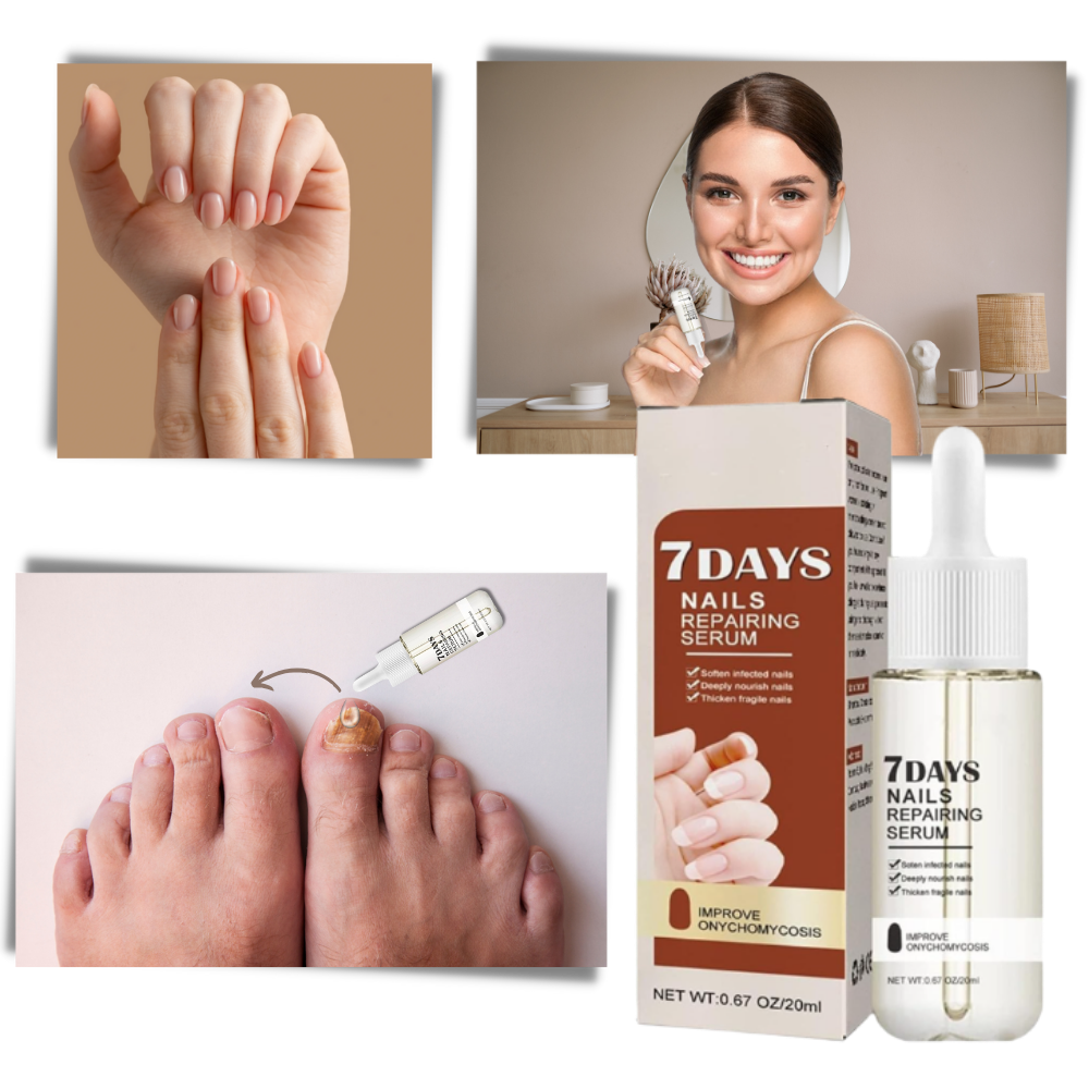 7 Days Nail Repair Essence | Filindra