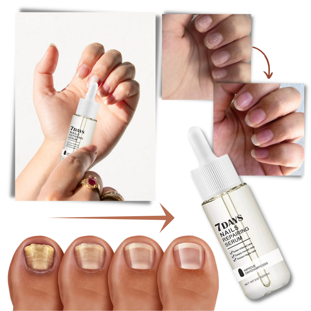 7 Days Nail Repair Essence | Filindra