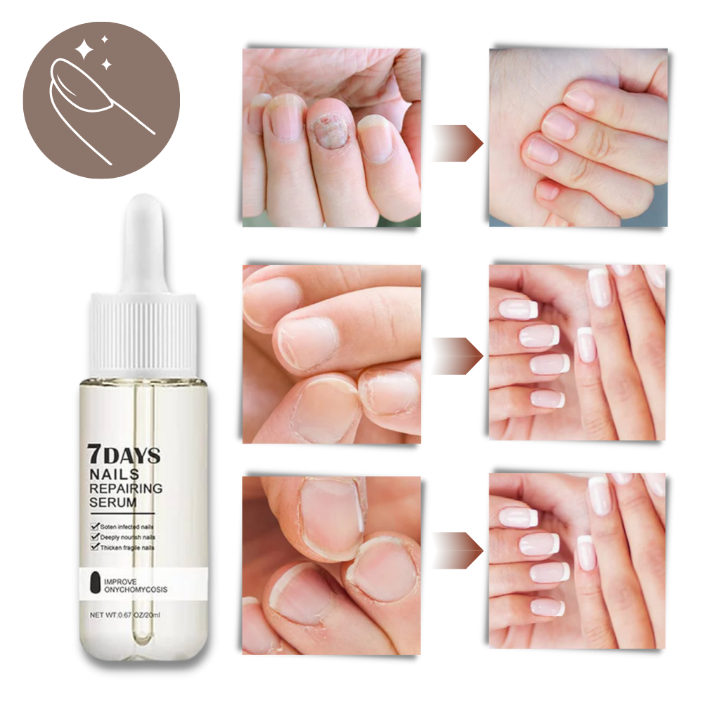 7 Days Nail Repair Essence | Filindra