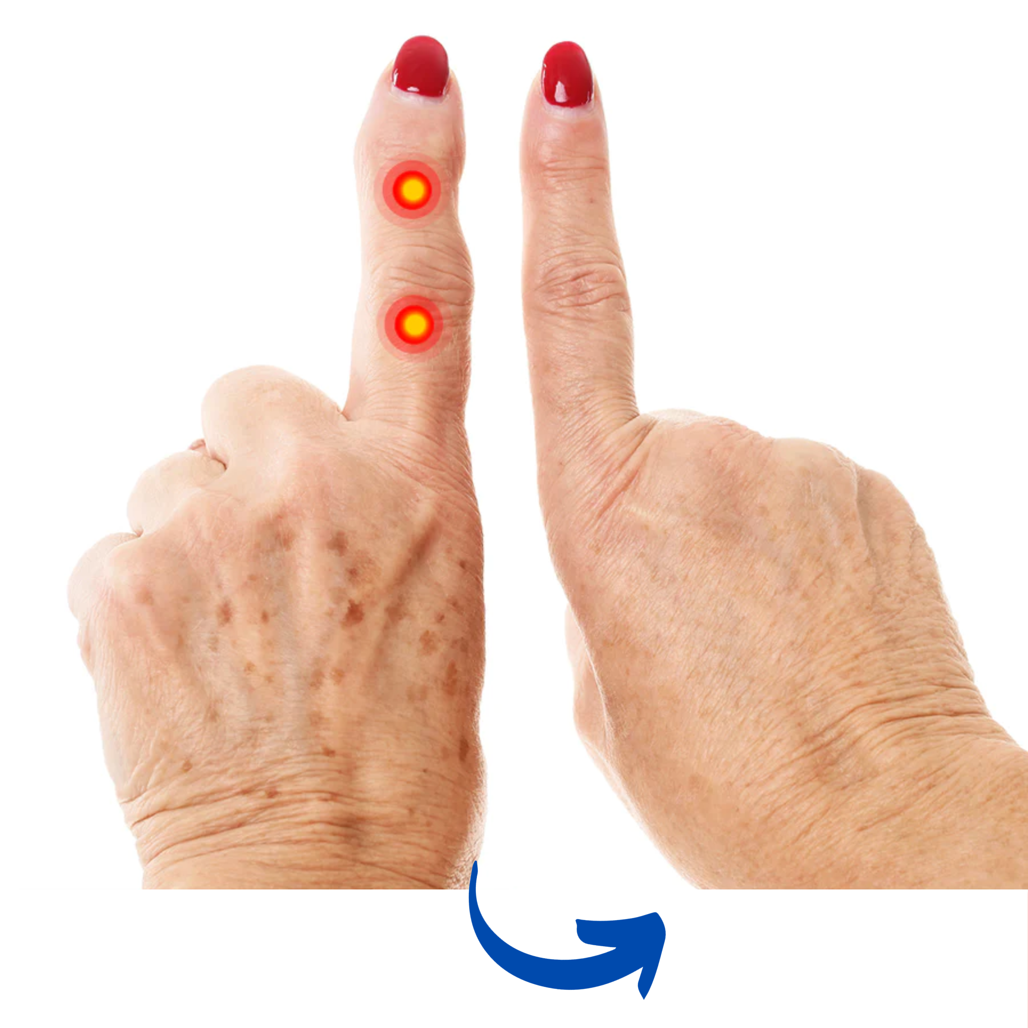 Red Light Therapy Arthritis Glove — Targeted Wavelength LEDs