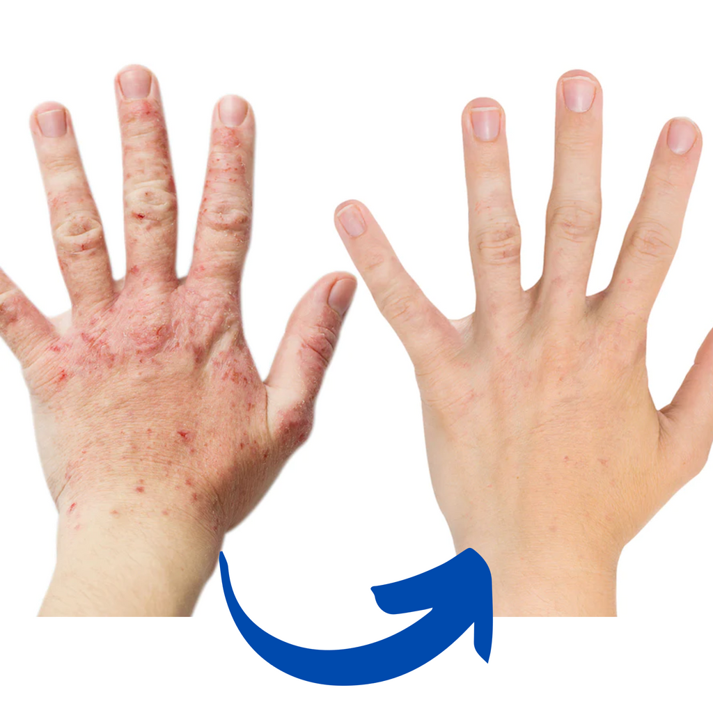 Red Light Therapy Arthritis Glove — Targeted Wavelength LEDs