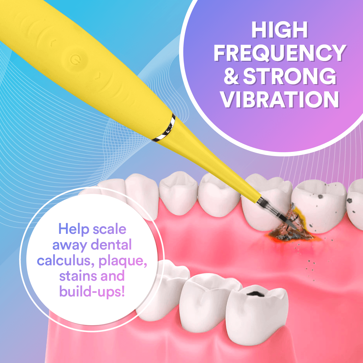 Elite Smile Technology prémium szónikus fogtisztító — professzionális szájápolási eszköz