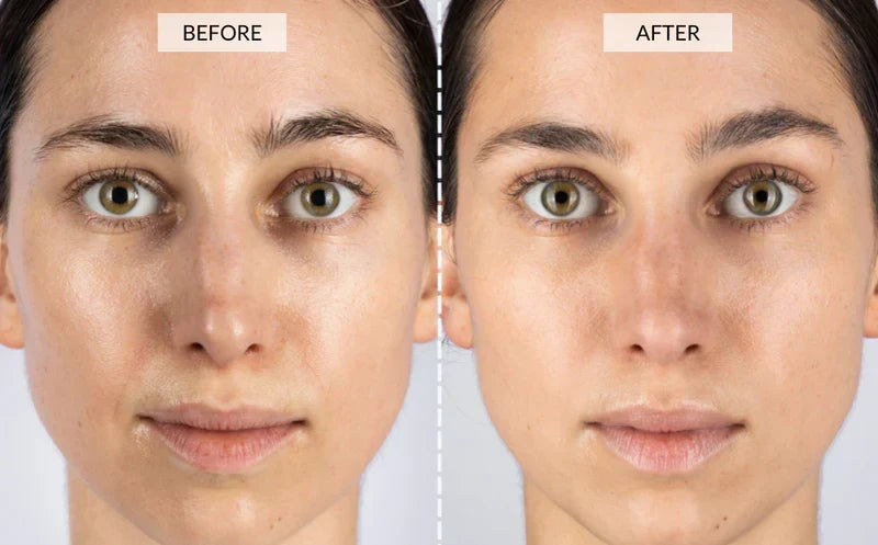 Vrimlo 7-Color LED Therapy Mask for Smoother Skin