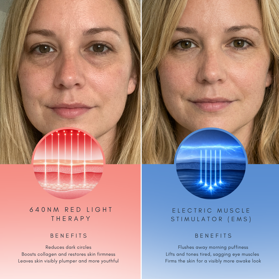 Dual-Tech Under Eye Rejuvenation Device — Red Light And EMS Therapy
