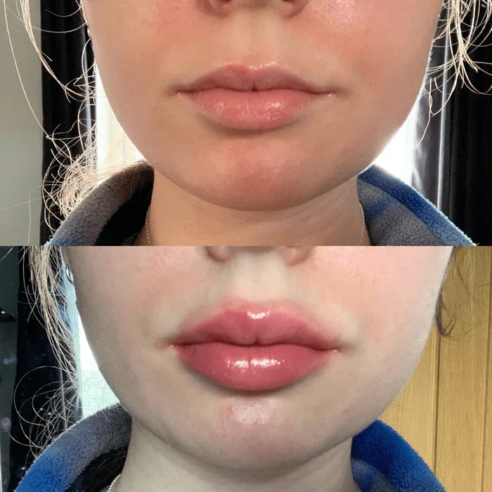 Natychmiastowe serum powiększające usta — szybko działające, zapewniające pełniejszy wygląd ust