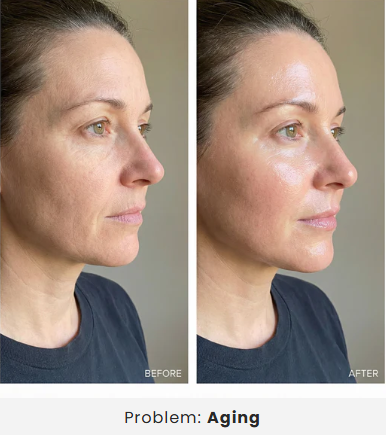 Five-In-One Facial Sculpting Device With EMS, Sonic Vibration And RGB LED Therapy