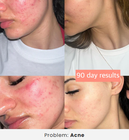 Five-In-One Facial Sculpting Device With EMS, Sonic Vibration And RGB LED Therapy