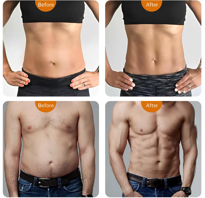 Abdominal Toning Belt — 10 Exercise Modes, 30 Intensity Levels