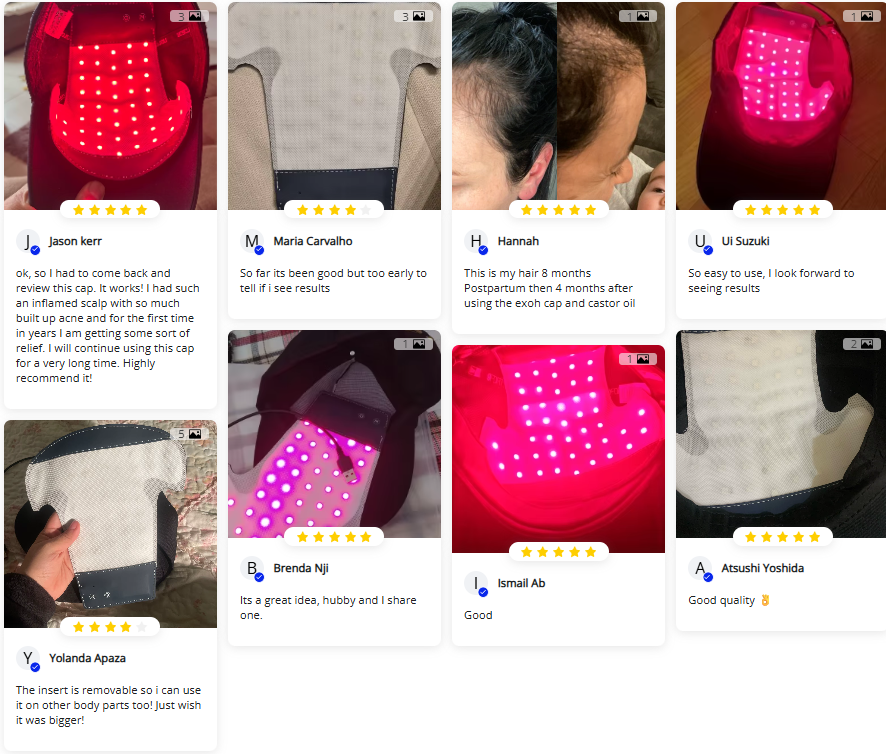 Wearable Red Light Therapy Cap — Red, Near-Infrared & Blue Light Diodes