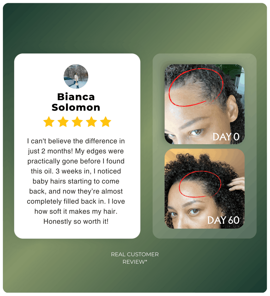 Authentic Batana Hair Treatment Oil — Hand-Extracted Scalp Formula