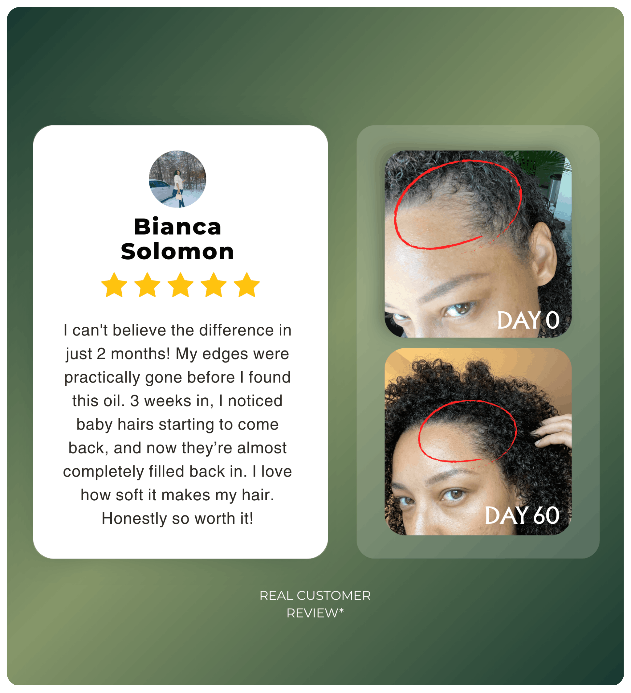 Authentic Batana Hair Treatment Oil — Hand-Extracted Scalp Formula