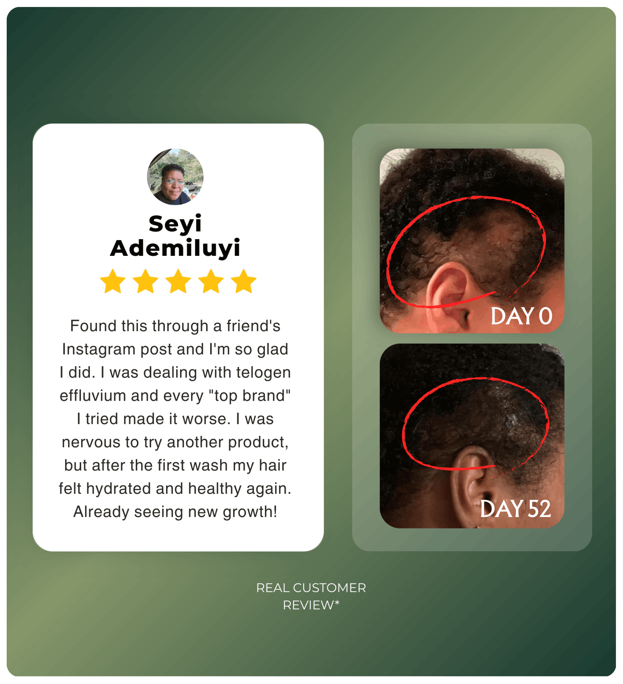 Authentic Batana Hair Treatment Oil — Hand-Extracted Scalp Formula