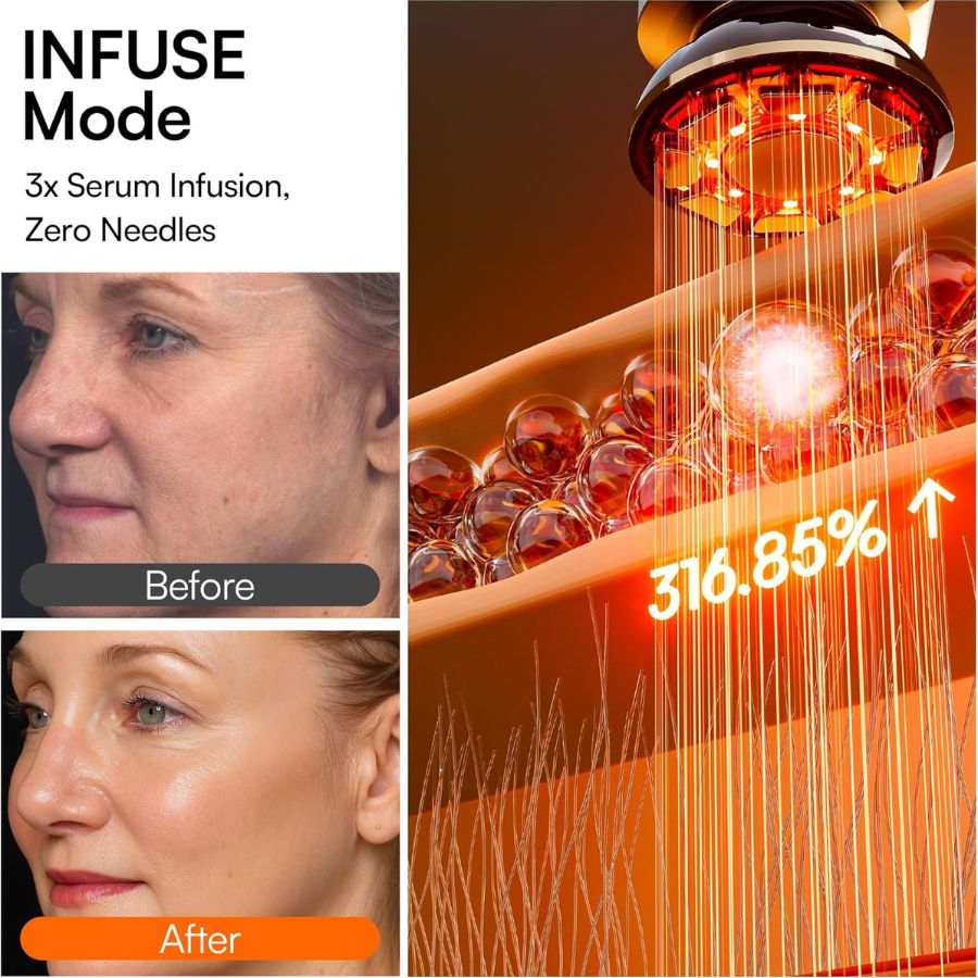 LuminaSculpt Facial and Neck Lifter — 10 Minute Jawline Sculpting and Collagen Activation