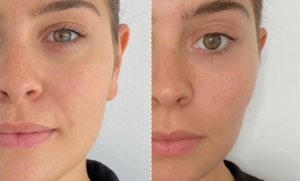 EMS Facial Toning and Lifting Mask — Hands-Free Skincare Device