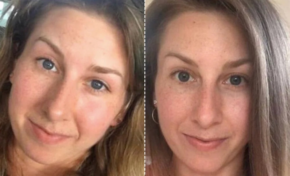 EMS Facial Toning and Lifting Mask — Hands-Free Skincare Device