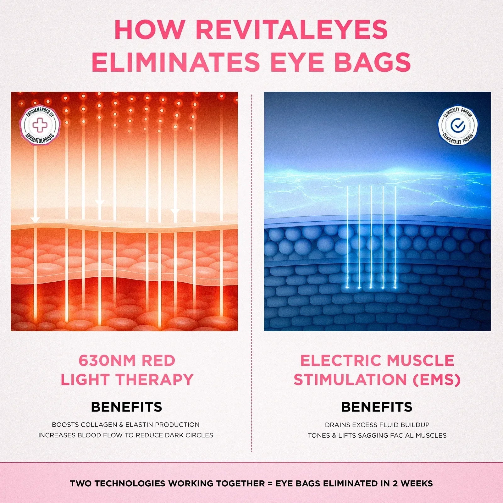 Kit RadianceLift de renovación del contorno de ojos en diez minutos — dispositivo de luz roja de 630 nm y microcorriente