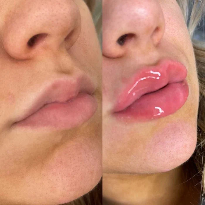 Natychmiastowe serum powiększające usta — szybko działające, zapewniające pełniejszy wygląd ust