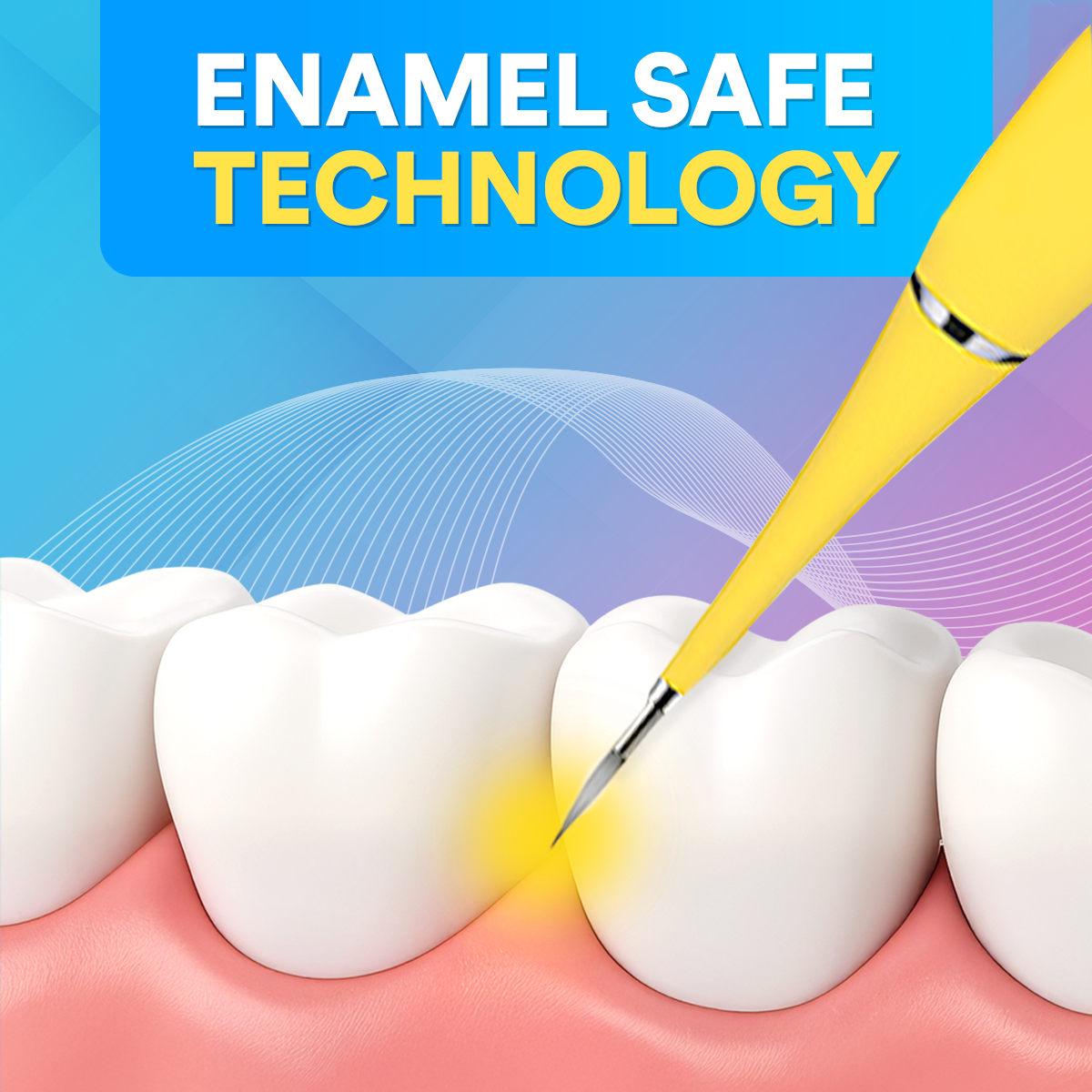Elite Smile Technology prémium szónikus fogtisztító — professzionális szájápolási eszköz