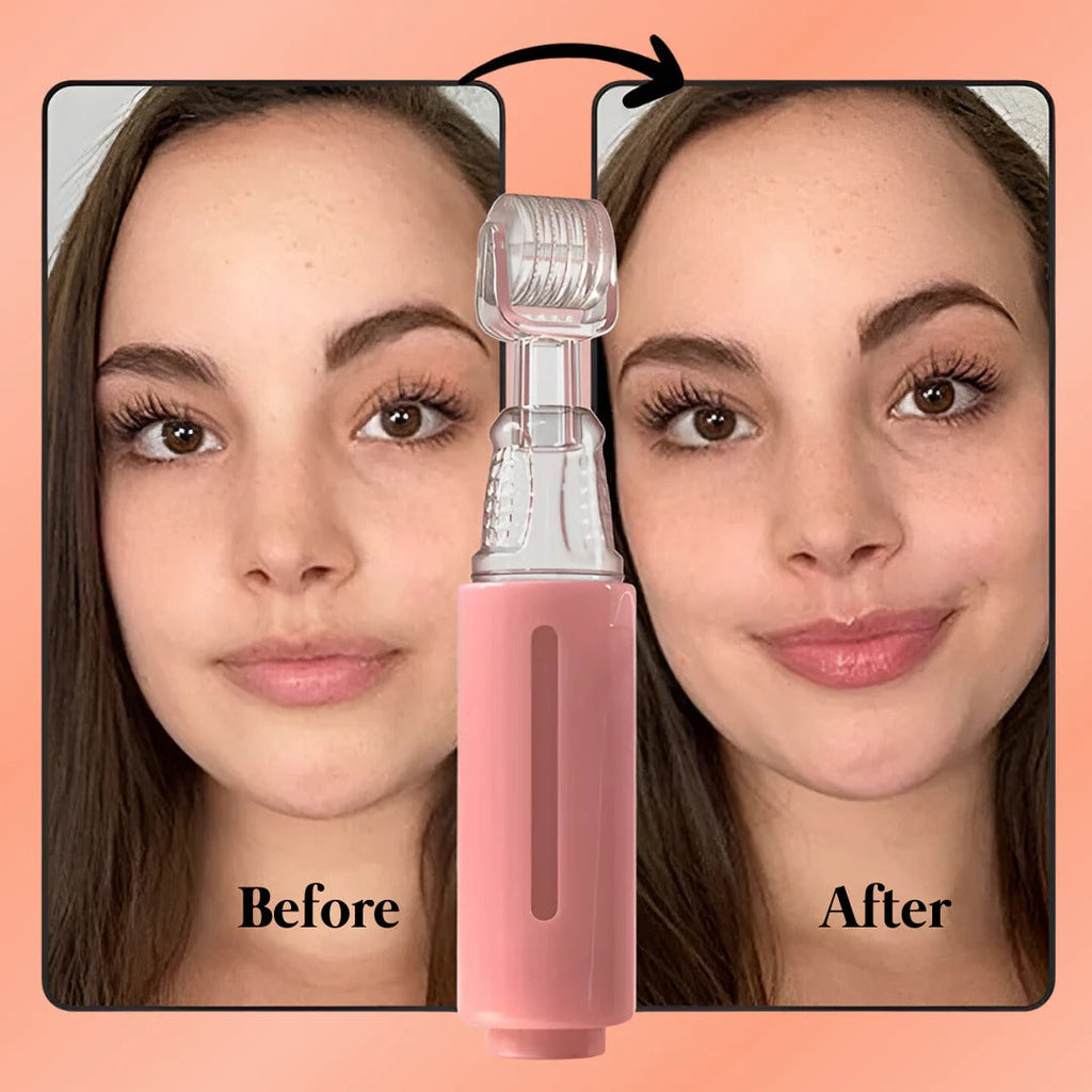 Lippen-Booster-Set — Sanfter natürlicher Lippenaufpolsterer, lang anhaltende Ergebnisse