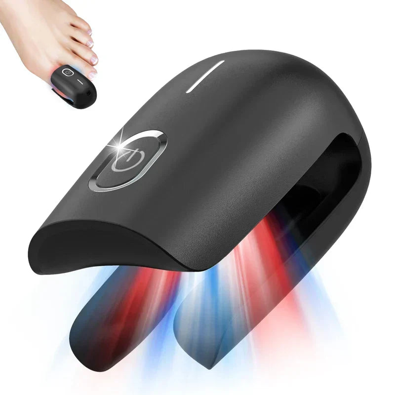 Anti-Fungal Toenail Laser Therapy Machine — Portable USB Charge