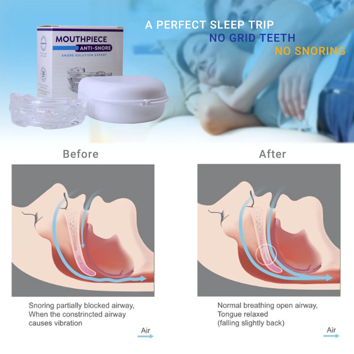 התקן נוח נגד נחירות NoSnore — לא פולשני, מוכן לנסיעות