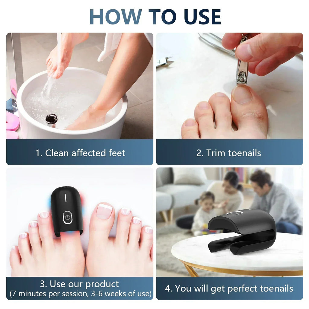 Anti-Fungal Toenail Laser Therapy Machine — Portable USB Charge