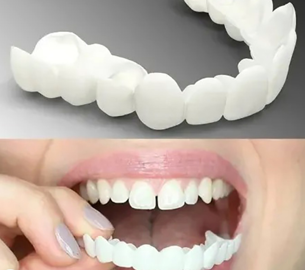 Adjustable Snap-On Dentures | Filindra