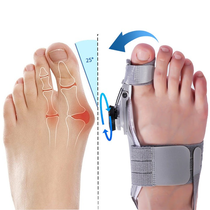 Kirrea justerbart hjälpmedel för stortåns positionering — universell passform, hallux valgus-skena