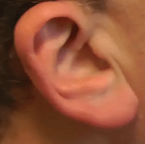 Appareils auditifs rechargeables invisibles NovaSound Duo — Paire intra-auriculaire discrète