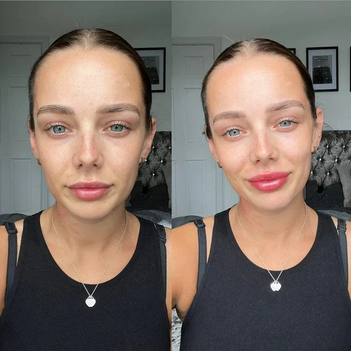 Natychmiastowe serum powiększające usta — szybko działające, zapewniające pełniejszy wygląd ust