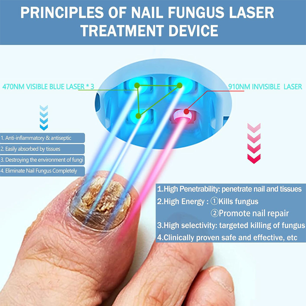 Professional-Grade Toenail Laser Treatment Device — Clinical Precision