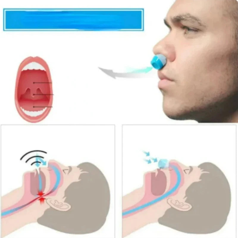 2-in-1 Anti Snore Device and Air Purifier Nose Clip | Filindra