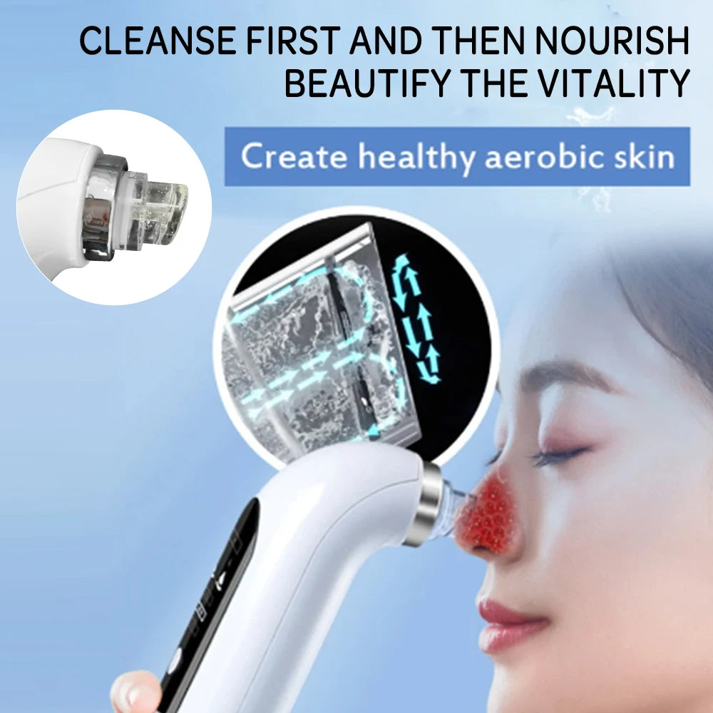 Aspirateur électrique amélioré pour points noirs et pores - nettoyage en profondeur