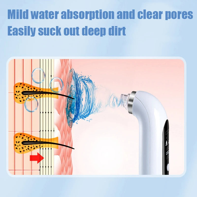 Aspirateur électrique amélioré pour points noirs et pores - nettoyage en profondeur