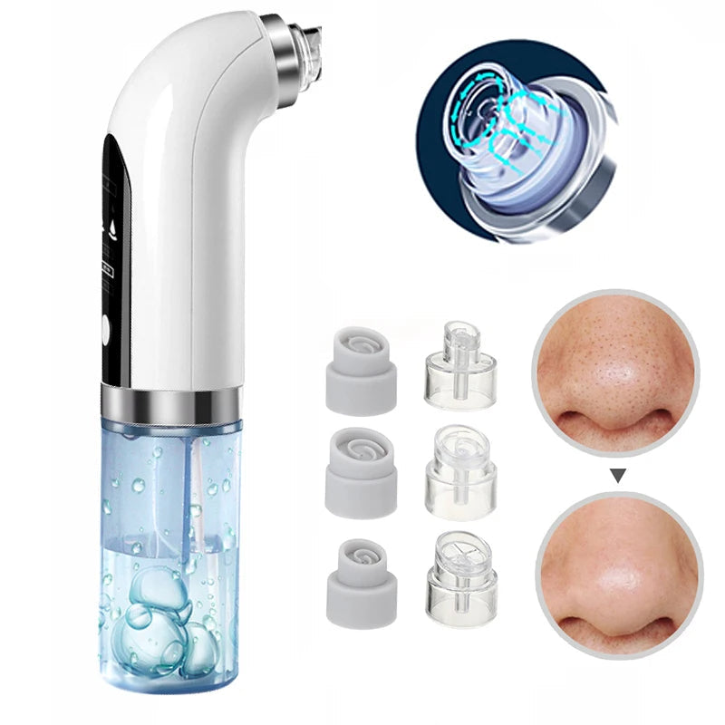 Aspirateur électrique amélioré pour points noirs et pores - nettoyage en profondeur